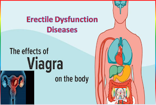 Erectile Dysfunction Viagra sildenafil pfizer