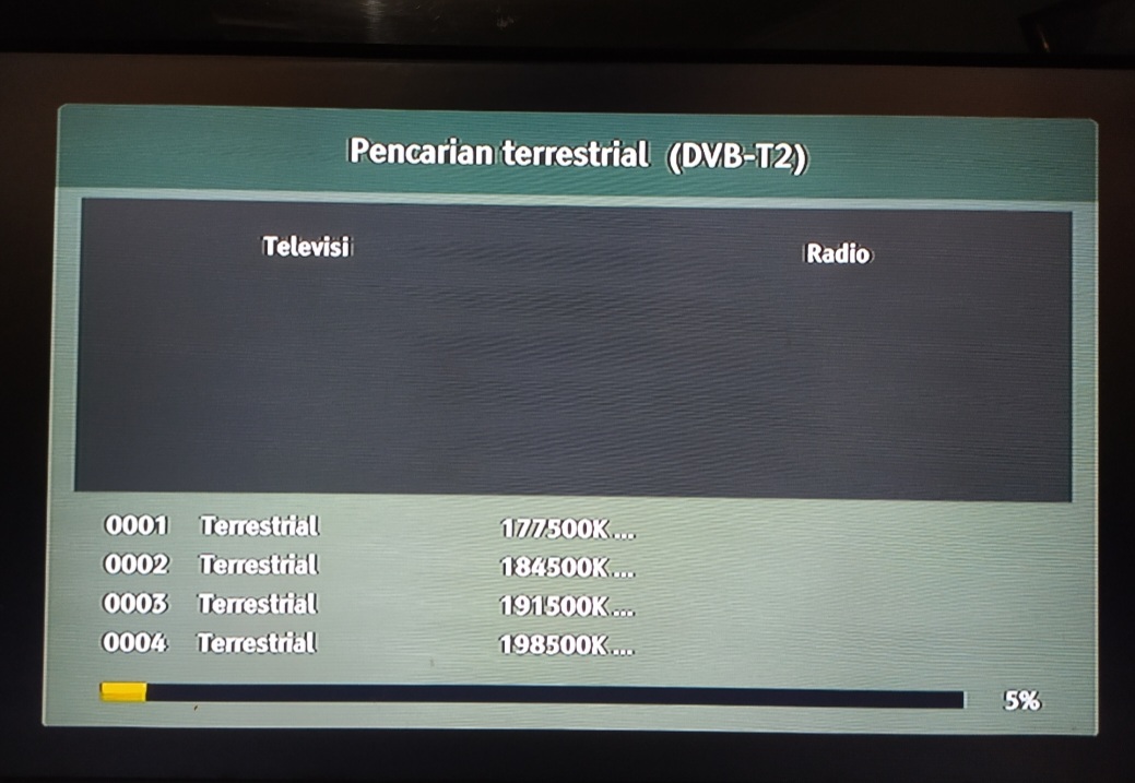 Pasang Set Top Box TV Digital