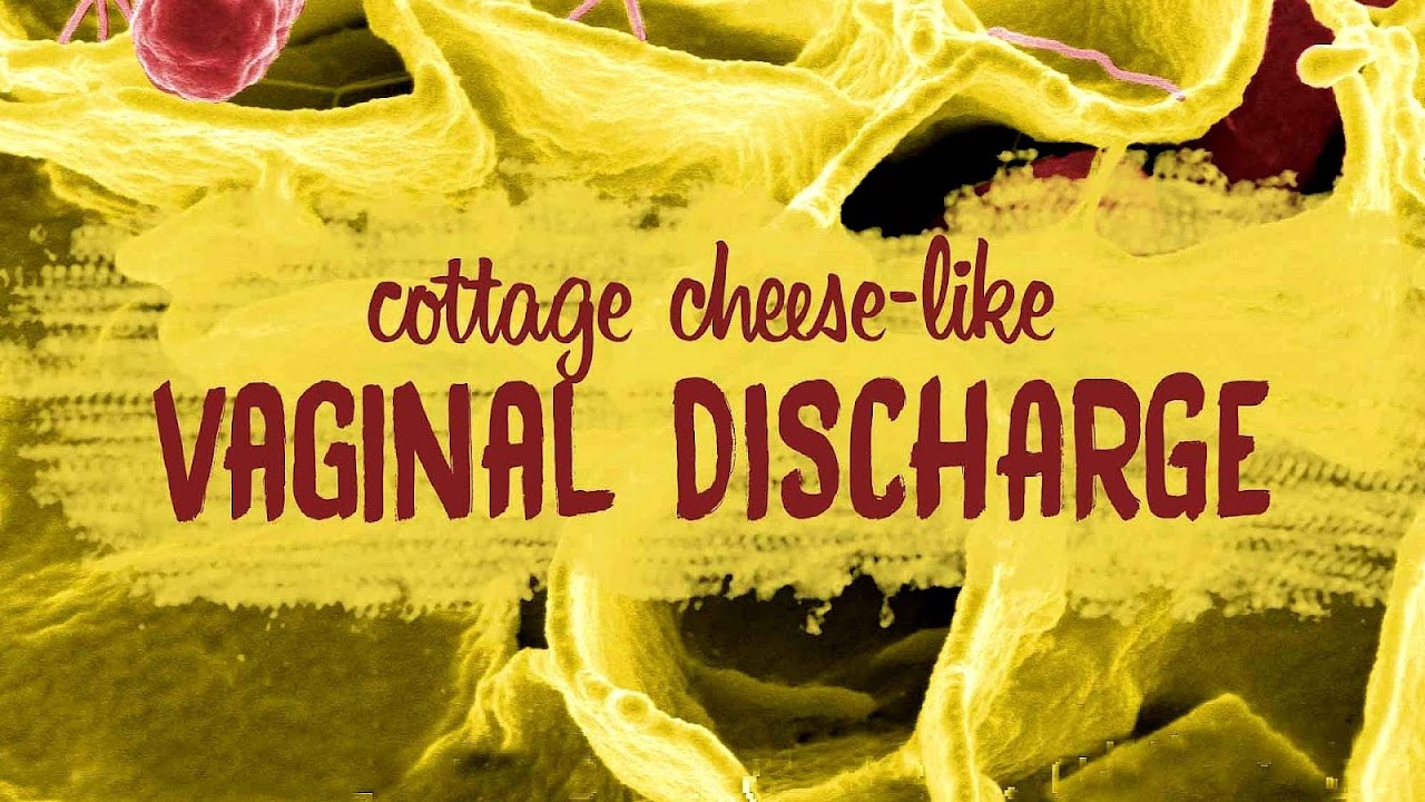 Yellow Discharge With Yeast Infection