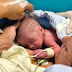 Đột phá y học: Mẹ cấy ghép tử cung đầu tiên sinh con