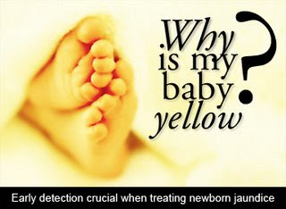 penyebab bayi kuning