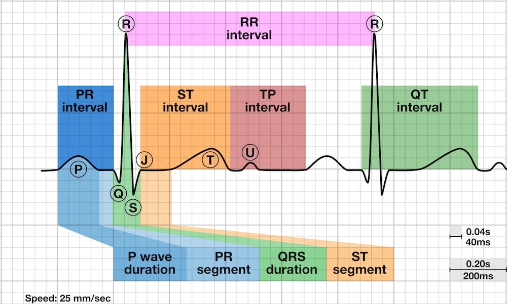 Gelombang EKG