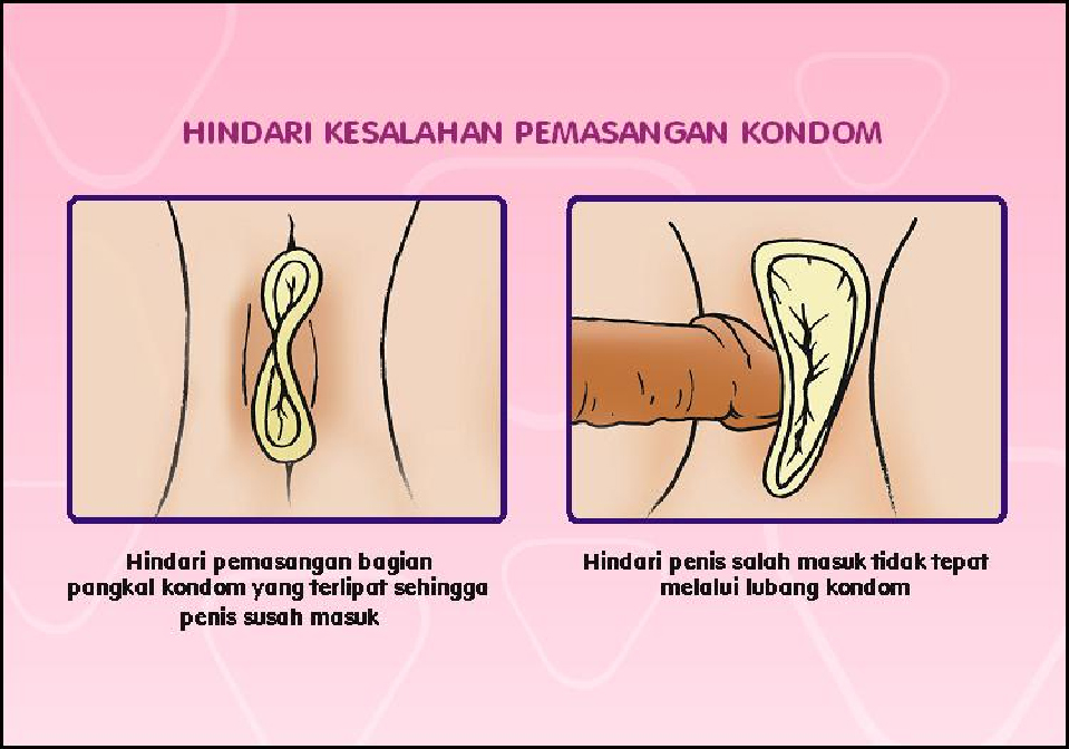 Catatan Liza Mengenal Kondom  Wanita  Female Condom 