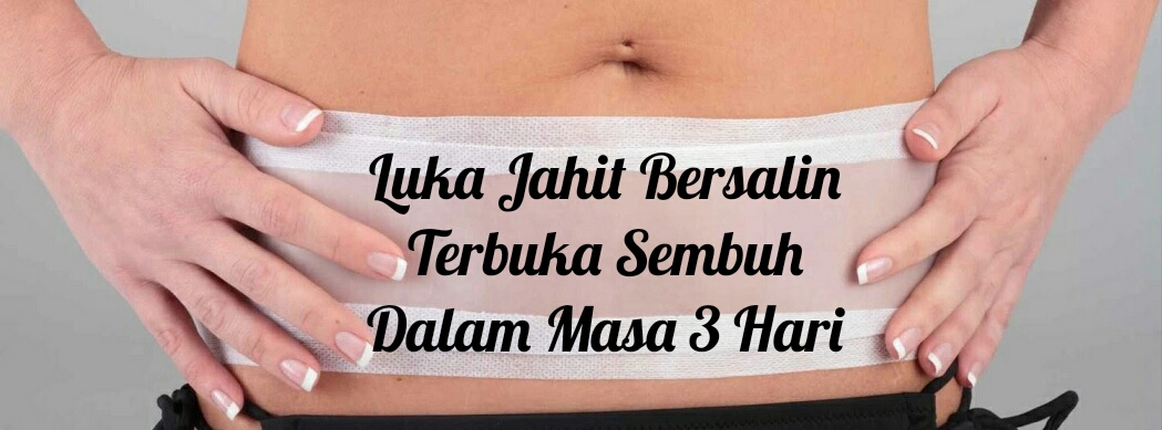 Luka Jahit Bersalin Terbuka Sembuh Dalam Masa 3 Hari , Pengedar Shaklee ipoh, pengedar shaklee batu pahat, set berpantang shaklee, set bersalin shaklee