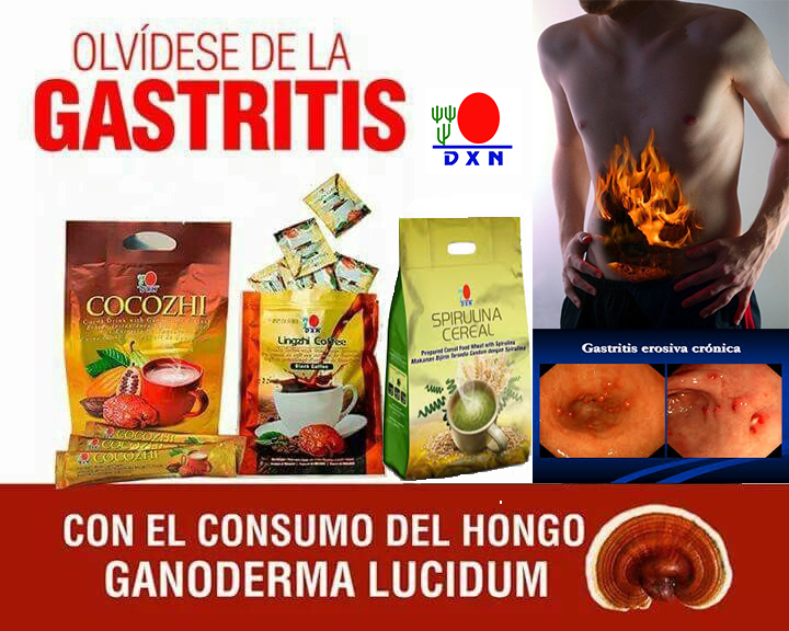 Tratamiento Natural Para La Gastritis Cronica Dxn Salud Dxn