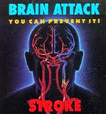 STROKE