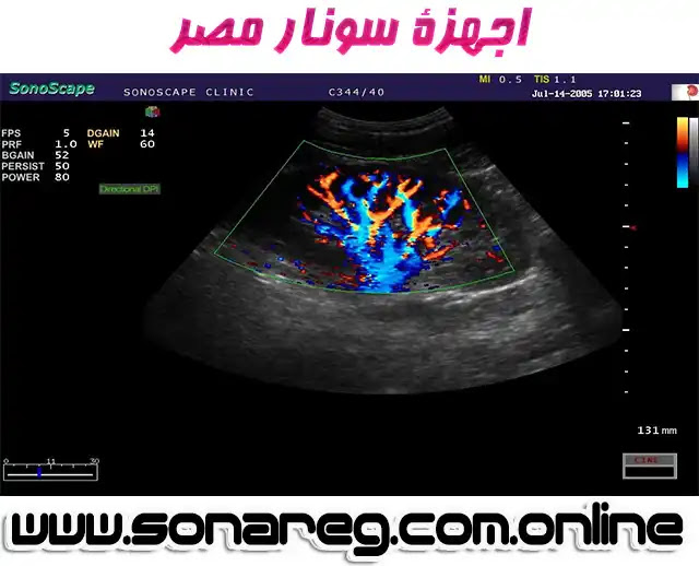 اجهزة سونار للبيع,اجهزة سونار مستعملة للبيع,اجهزة سونار مندراي,اجهزه سونار,بيع اجهزه سونار جديد ومستعمل,جهاز سونار,اجهزة سونار مستعمل للبيع,اجهزة سونار مصر,اجهزه سونار في مصر,اسعار اجهزة سونار مصر,اجهزة سونار للبيع فى مصر,اسعار اجهزة سونار للبيع,سعر جهاز السونار,شراء جهاز سونار,شركات اجهزة سونار فى مصر,اجهزة السونار,شراء اجهزة سونار,اجهزة سونار سامسونج,سعر جهاز سونار,سونار سونوسكيب,جهاز سونار مستعمل,اجهزة سونار جي ايه,اسعار اجهزة سونار توشيبا,اجهزة سونار بيطرية,اجهزة سونار بيطري,اسعار اجهزة السونار بمصر