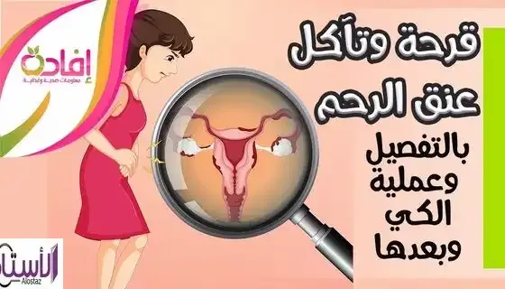 Cervical-ulcer-in-detail-video