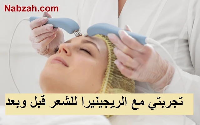 تجربتي مع الريجينيرا للشعر قبل وبعد