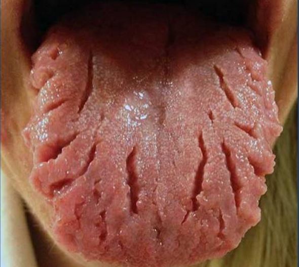 The appearance of your tongue has something to say about your health!