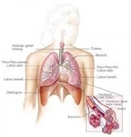 Pengobatan Tradisional Paru-Paru Kering