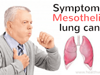 Mesothelioma Cancer - Do You Know Where It Comes From?