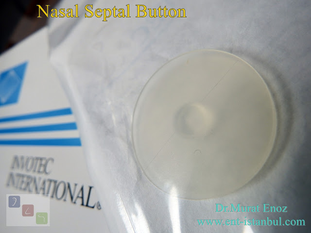 Septal Button Contraindications?,How To The Septal Button Be Placed?,Care Recommendations After Septal Button Application,Nasal Septal Button,Septal Button Application Details,