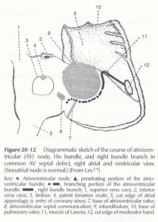 conducting system of heart. Conduction System - Normal