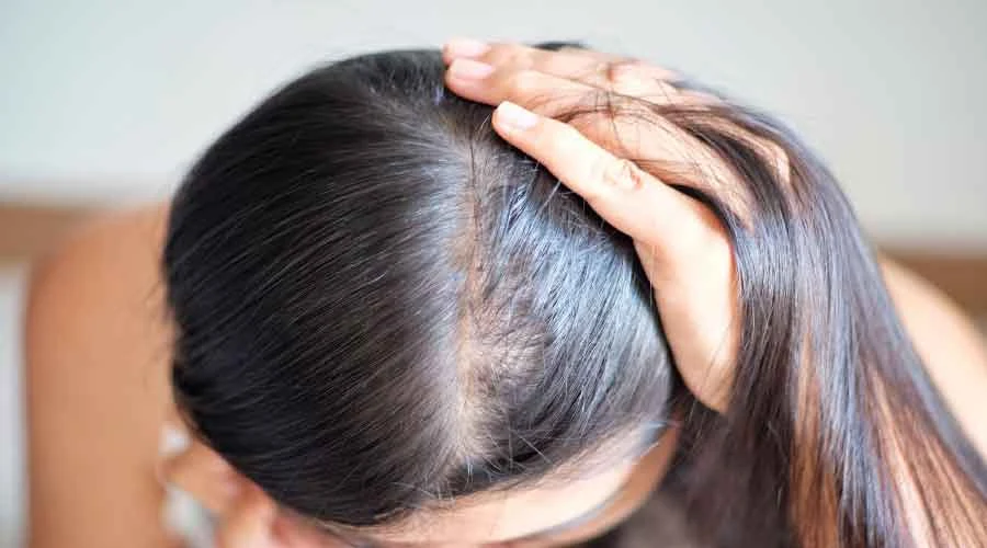 علاج تساقط الشعر في المنزل طبيعيا - ورقـة بـلـس