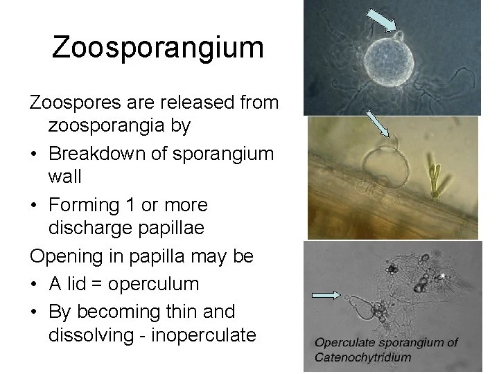 papilla in zoosporangium