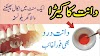 How to Get Rid of Tooth Decay (Cavities) Naturally and Medically