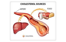 Solusi Agar Kolesterol Tetap Normal