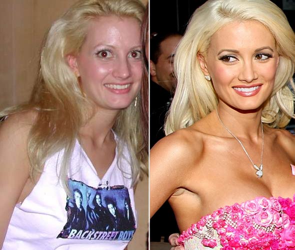 Holly Madison before and after plastic surgery (image hosted by plasticsurgerycelebrity.com)