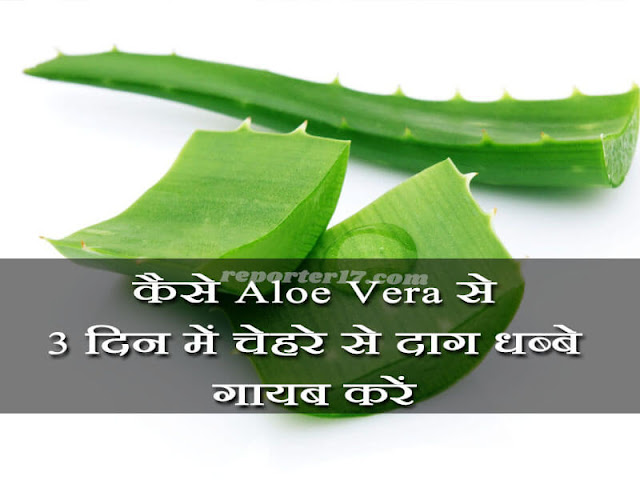 How to remove Pimples Marks with using Aloe Vera