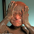 Meet 11-year-old boy with tragic skin condition that makes him look like a statue