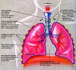 Pengertian Mesothelioma, Penyebab jenis dan Gejala