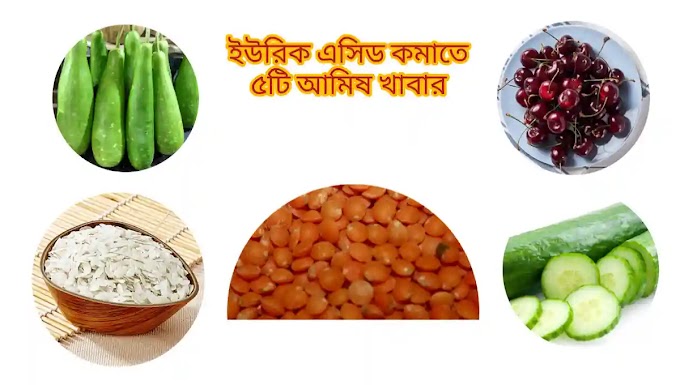 ইউরিক এসিড কমাতে ৫টি নিরামিষ  খাবার।