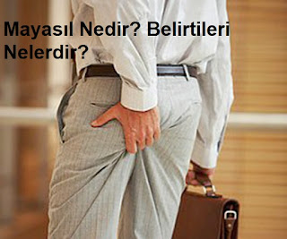 Mayasıl Nedir? Belirtileri Nelerdir?