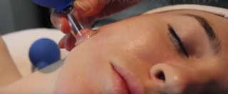 FACIAL CUPPING ATAU BEKAM WAJAH Mengatasi Penuaan Dini dengan Terapi Spa Bekam Wajah