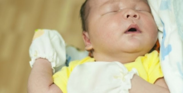 Kenapa Bayi Kena Penyakit Kuning Selepas Dilahirkan?
