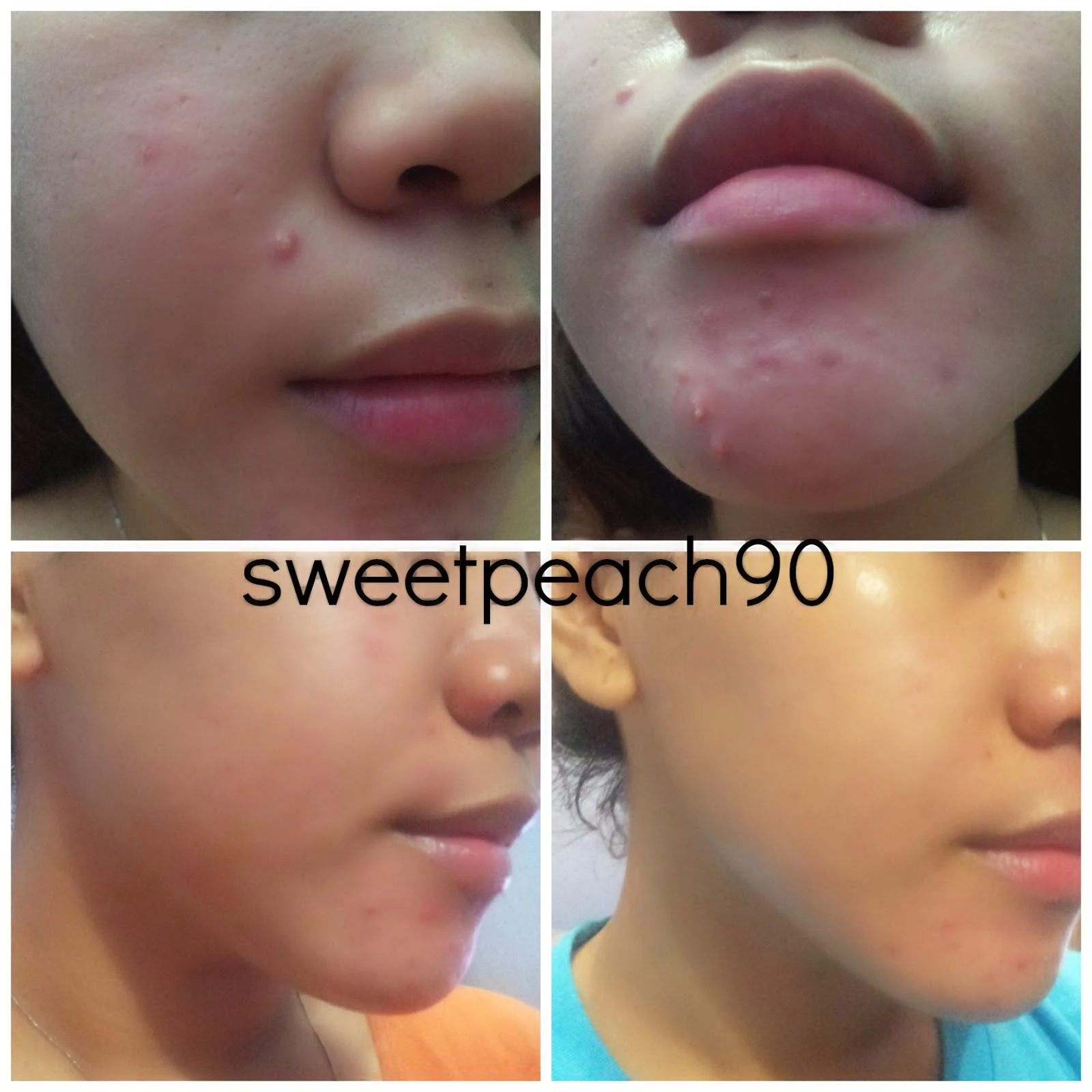 Sweet Peach REVIEW HADA LABO Shirojyun Ultimate Whitening