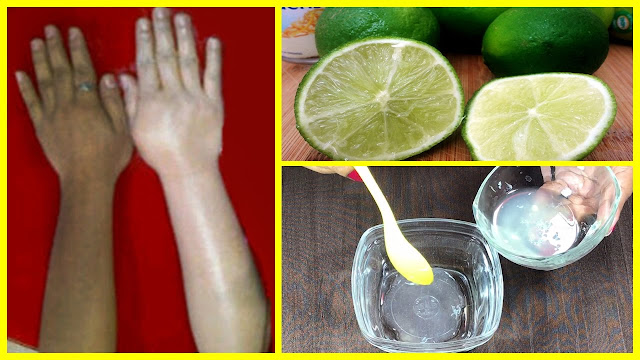 Skin Whitening Tips Using Lime