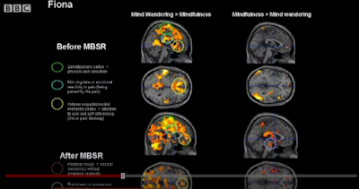 Mindful meditation MRI Results