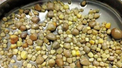Rasa sakit Perut Nenek Ini Ternyata Ditemukan Batu Sebanyak 806 biji Dalam Tubunya