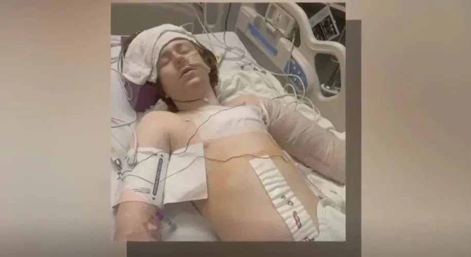 13-Year-Old Boy With Autism Is Shot Several Times By Police In Salt Lake City, Utah