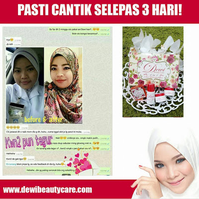 Dewi Beauty Care Skincare Murah