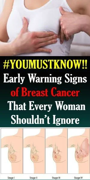 Early Breast Cancer Symptoms !