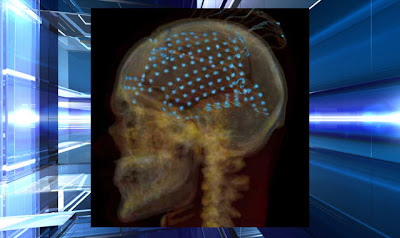 Computer Used To Decode Brain Activity