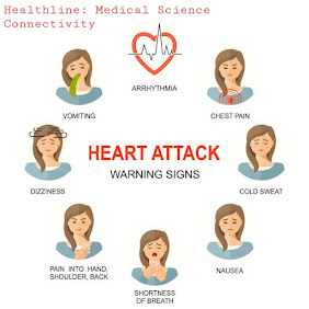 Signs and symptoms of Heart Attack in Women