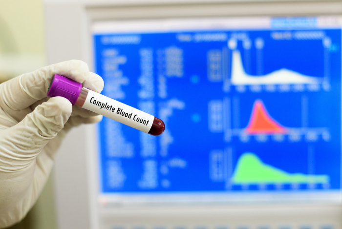 Pemeriksaan Hematologi Rutin untuk Uji Darah Diferensial