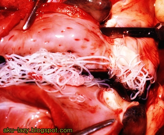 AKU MALAS: Cintai Cacing penyerang Jantung hatiku!!