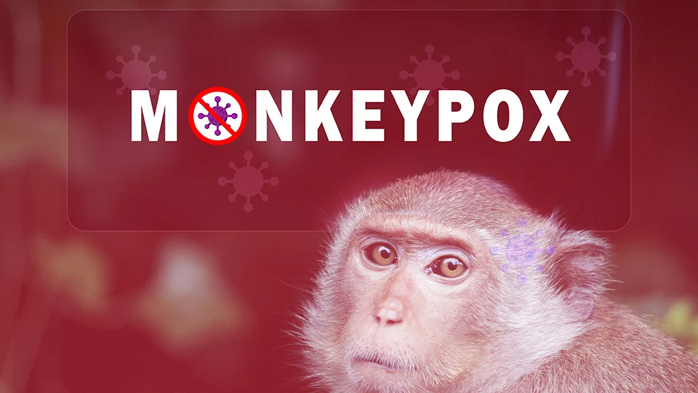 Healthy skepticism appropriate when considering monkeypox, says Dr. Peter McCullough