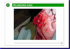 1. ALAT PELINDUNG DIRI_004