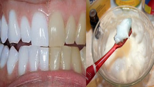 como clarear os dentes em casa