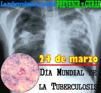 Imágen por el Día Mundial de la Tuberculosis