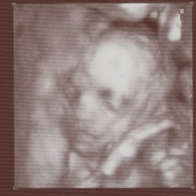 3d ultrasound pictures of twins. 3D Ultrasound of the twins