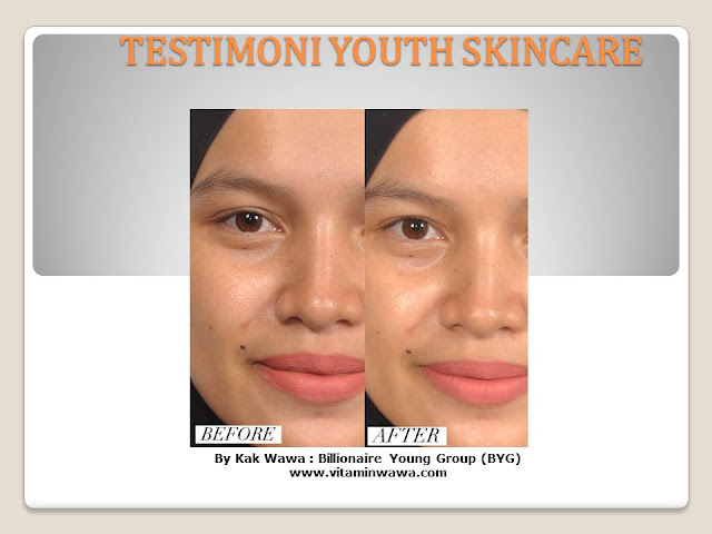 34 Testimoni Youth Skincare Shaklee Terbaru, Youth skincare shaklee, testimoni youth skincare shaklee, Youth Skincare Shaklee : Harga dan Review Pengguna Youth Shaklee, testimoni youth skincare shaklee, testimoni youth skincare shaklee