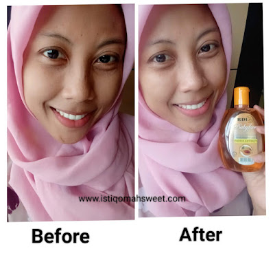 before after RDL facial cleanser Papaya