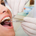 Chia sẻ kinh nghiệm khi tiến hành bọc răng sứ