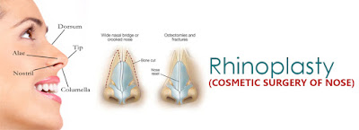 Rhinoplasty in hyderabad